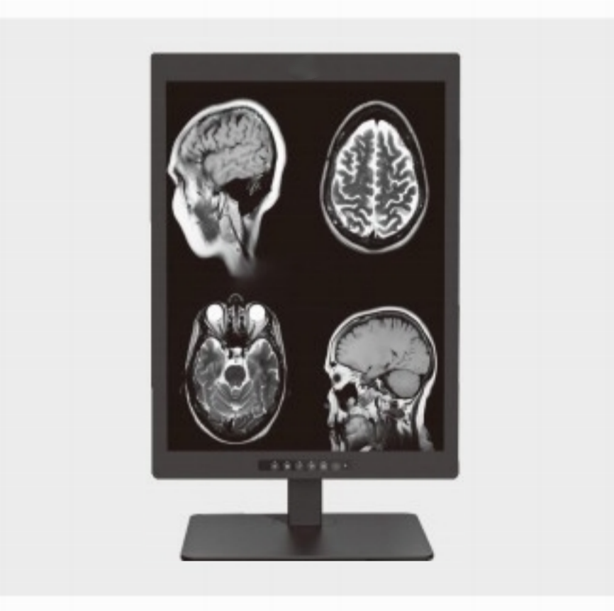 Dove viene comunemente utilizzato un display diagnostico medico da 20,1 pollici e 2 MP?