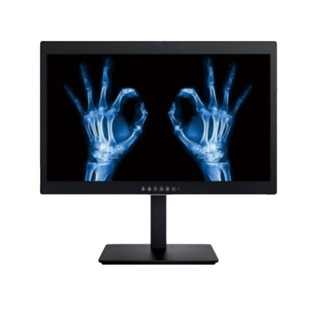 Pensi che i display diagnostici medici ospedalieri da 24 pollici e 2 MP siano solo normali monitor per computer commerciali?