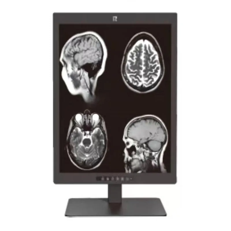 Display diagnostico medico da 3 MP da 21,3 pollici
