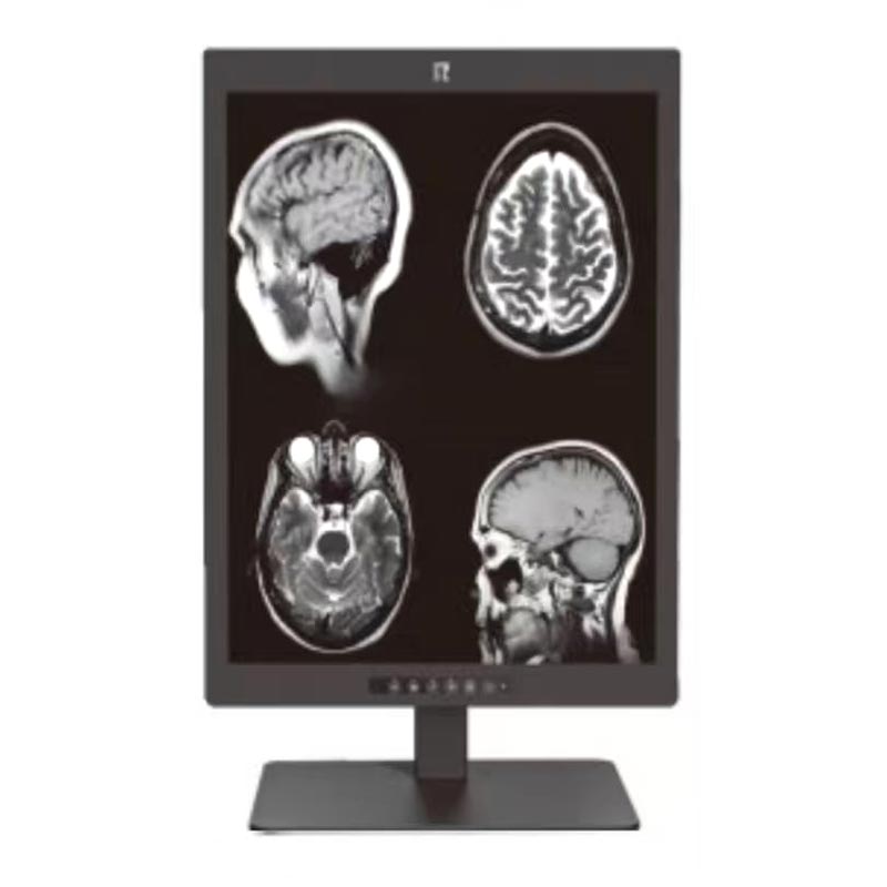 Monitor diagnostico medico da 21,3 pollici 3MP