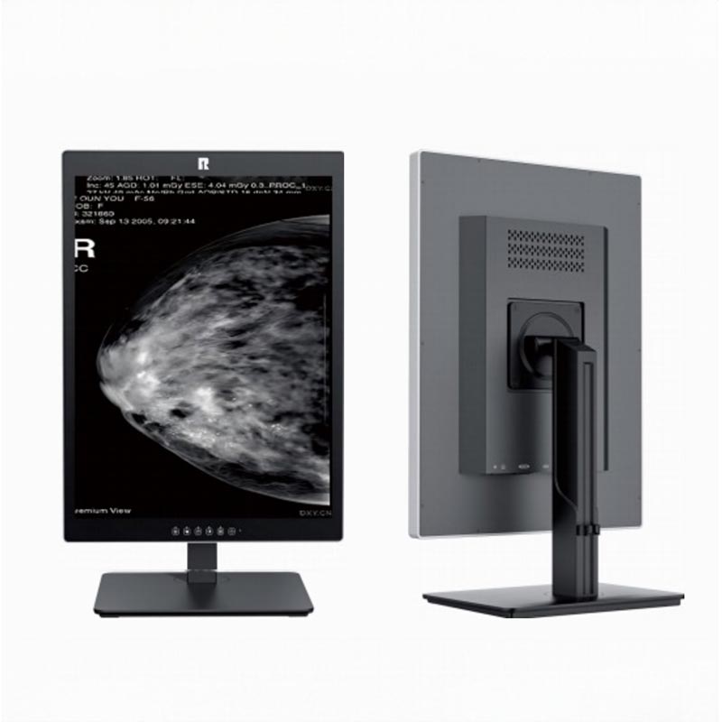 Monitor diagnostico medico da 21,3 pollici e 5 MP