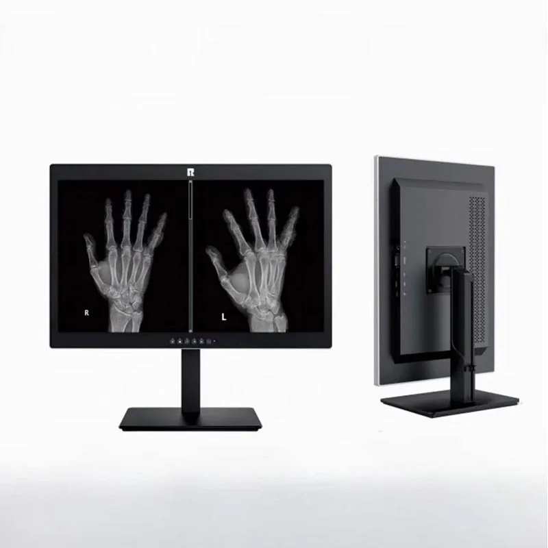 Display diagnostico medico da 24 pollici e 2 MP