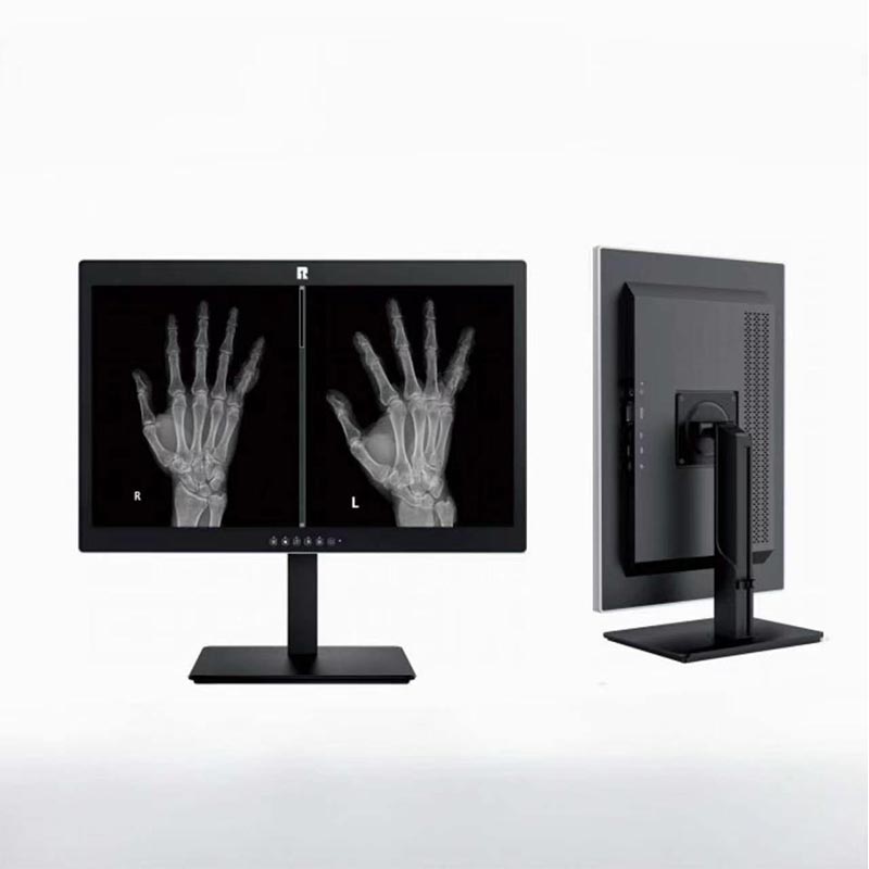 Monitor diagnostico medico da 2 MP da 24 pollici