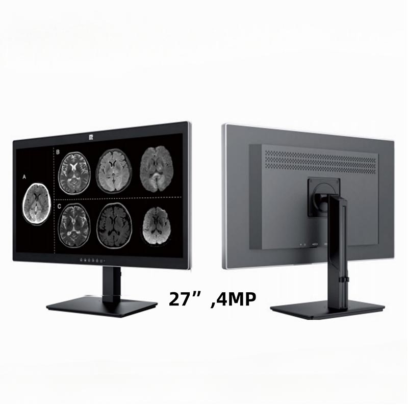 Display diagnostico medico da 27 pollici e 4 MP