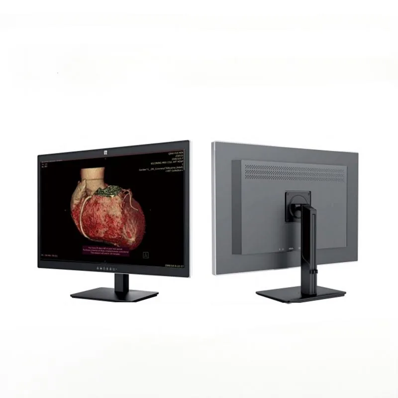 Monitor diagnostico medico da 30 pollici e 6 MP