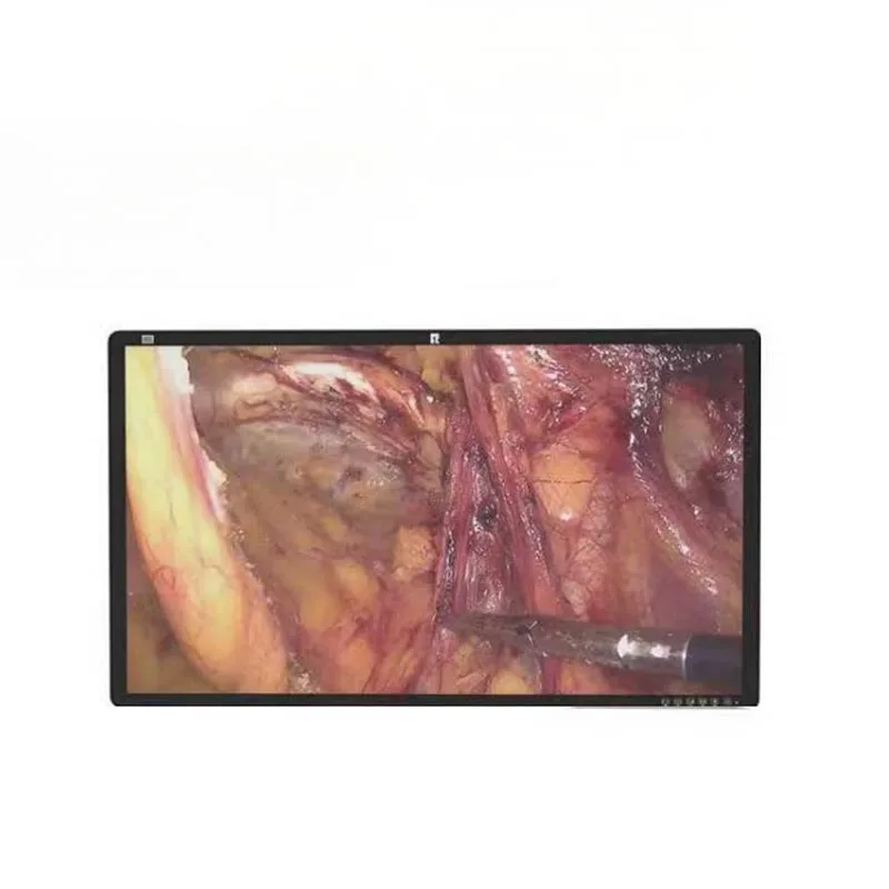 Monitor medico chirurgico 4K da 32 pollici