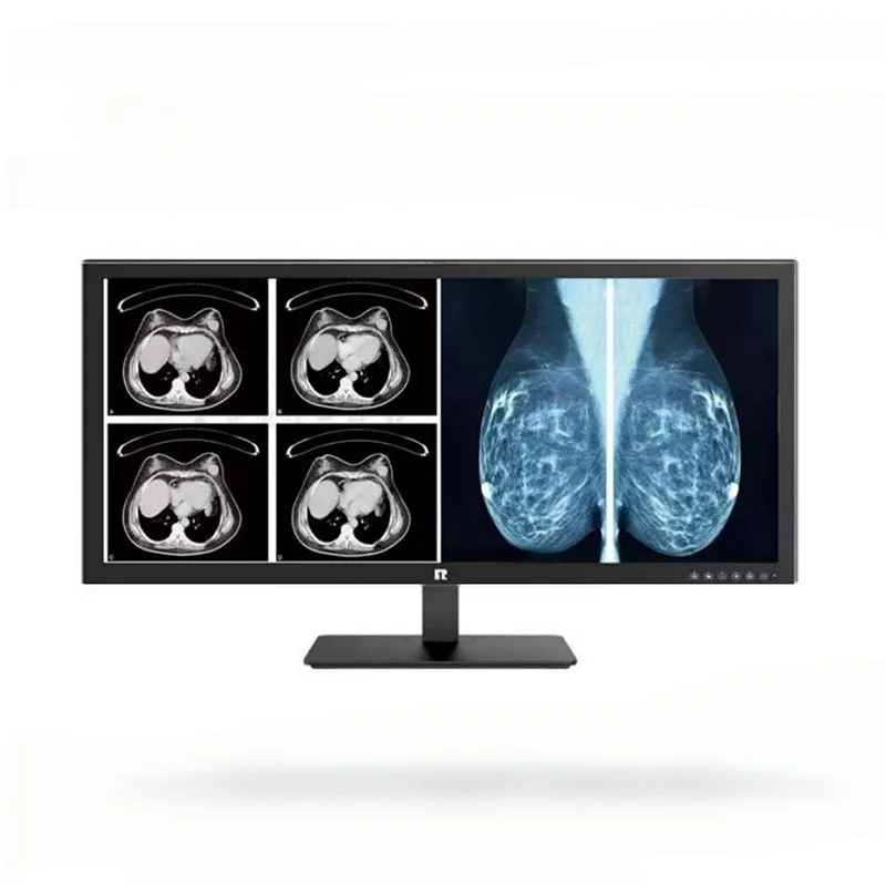 Monitor diagnostico medico da 34 pollici e 5 MP