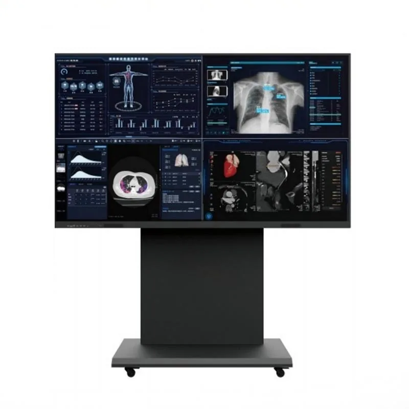 Terminale per monitor per consultazione medica da 86 pollici e 8 MP