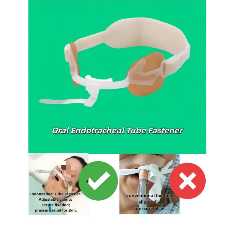 Dispositivo di fissaggio per tubo endotracheale