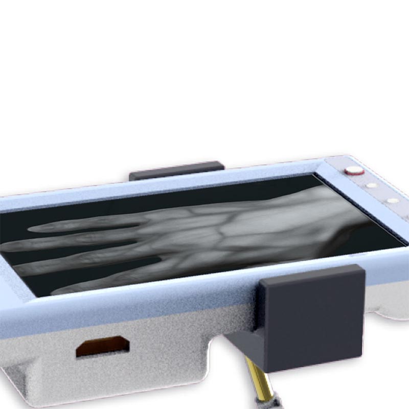 Tablet Vein Finder