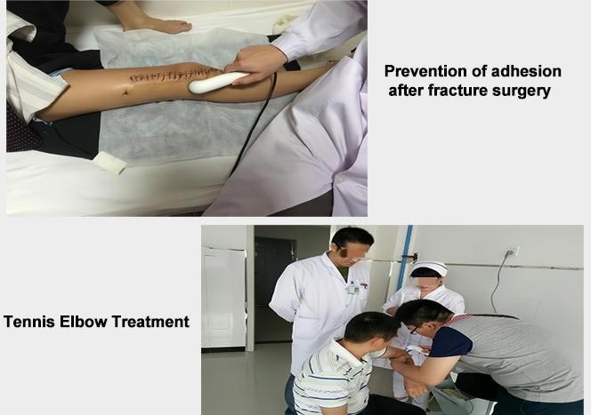 Ultrasound Therapy Device