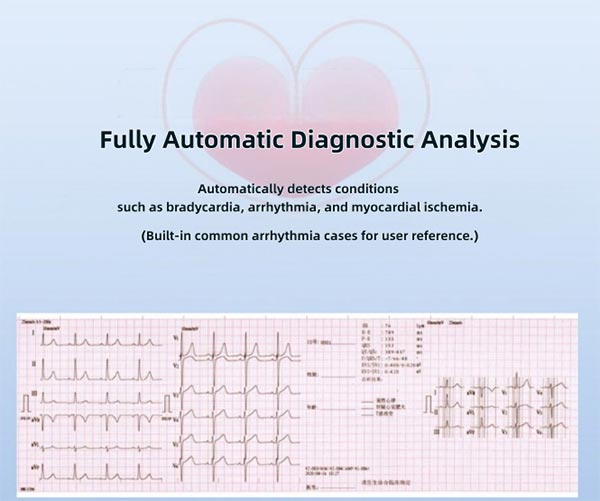Electrocardiogram Machine